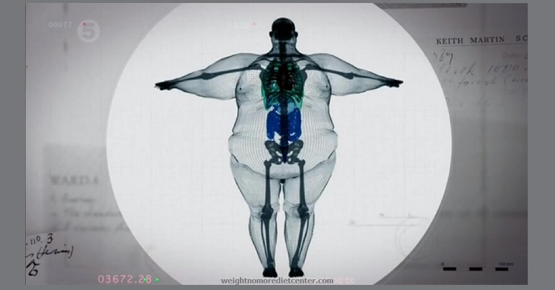 The Big Boned Theory - Weight☆No☆More℠ Diet Center