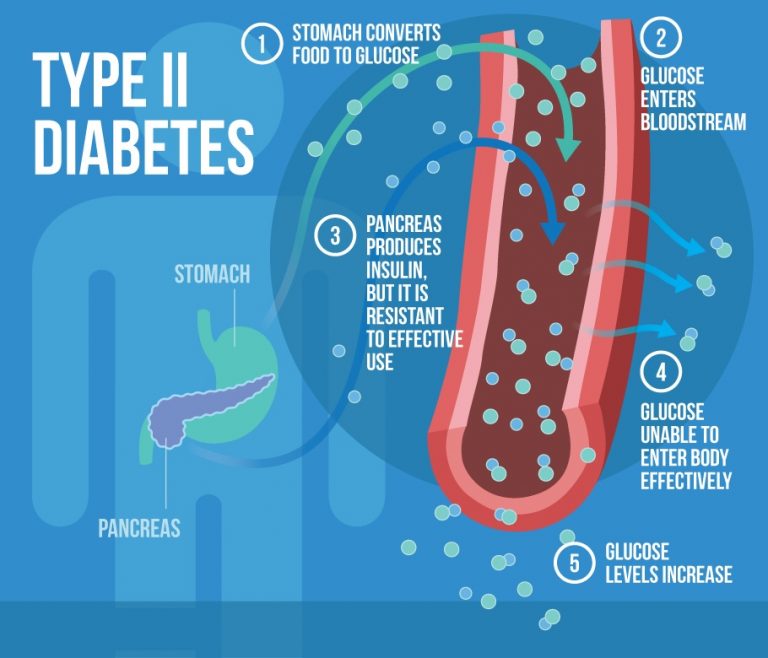 type-2-diabetes-and-obesity